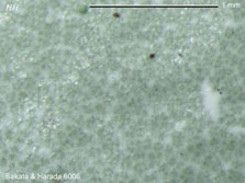 Menegazzia