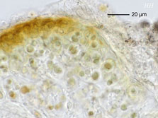 cepha-pelt