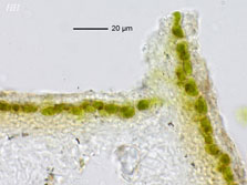 cepha-pelt