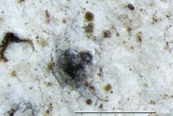 Megalotremis