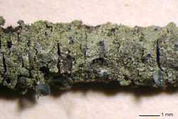 Pseudocalopadia