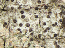 Gyalideopsis