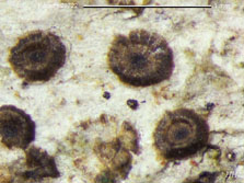 Gyalideopsis