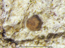 Gyalideopsis