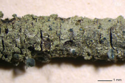 Pseudocalopadia