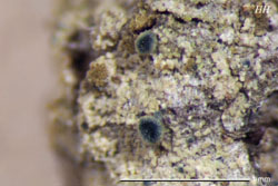 Pseudocalopadia